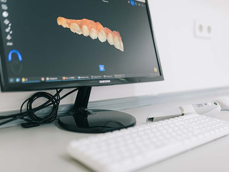 Clínica dental de Ana Ortolá en Oliva